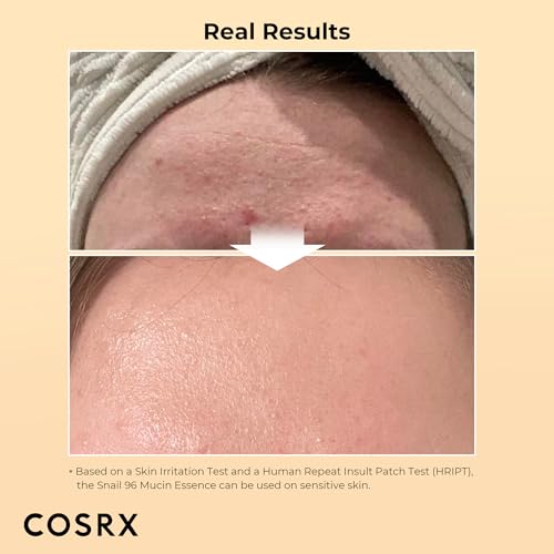 COSRX Snail Mucin Repairing Serum 100ml, Hydrating Serum for Face with Snail Secretion Filtrate for Dull Skin & Fine Lines, Korean Skin Care - Image 3