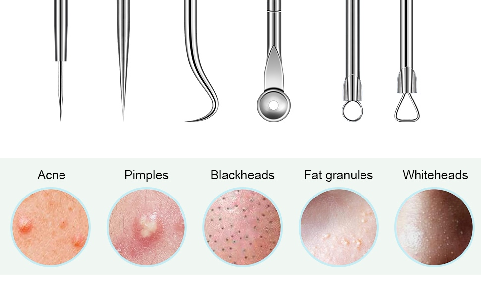 gun kit tool skin tag removal kit black head remover for nose tool skin care tools pore vacuum